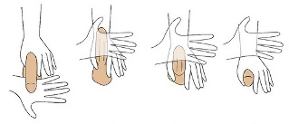 a técnica de ampliación do pene